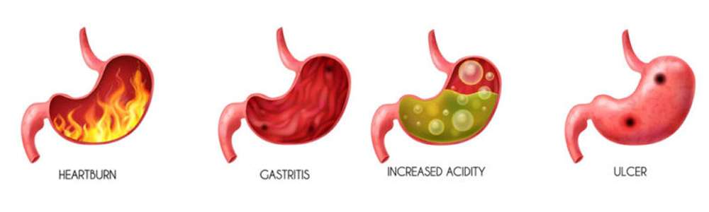 Gastroenterology