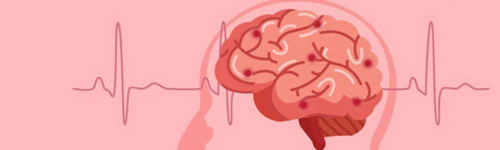 Neurology